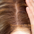 Medical Hair Wig 16